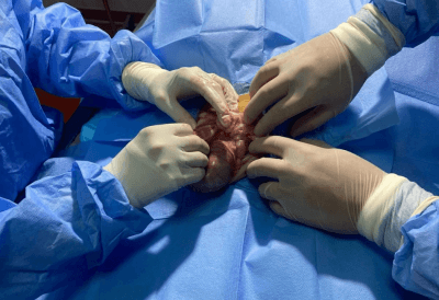 Piometrul – Infecția piometrală