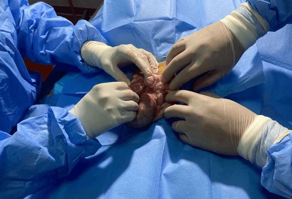 Piometrul – Infecția piometrală